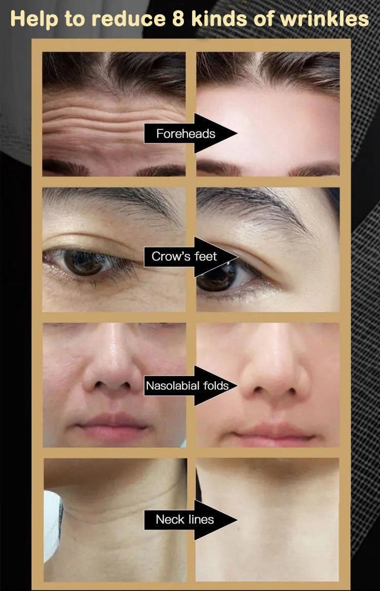 2023 New Anti Wrinkle Face Cream - Improve skin quality & Prevent skin aging & Permanent skin rejuvenation